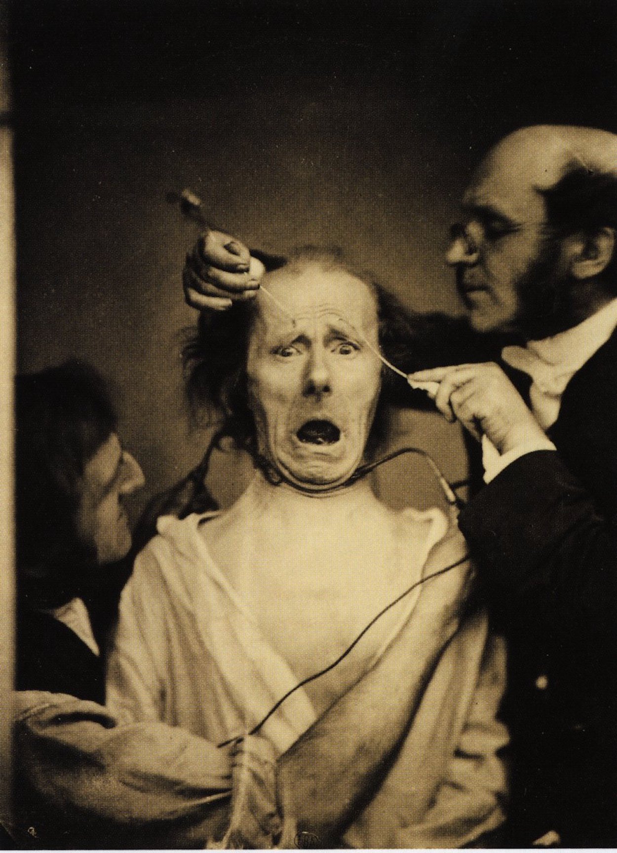 Duchenne and his assistant invoke an expression of fear using electrostimulation by Paul Nadar - c. 1862 Wellcome Library